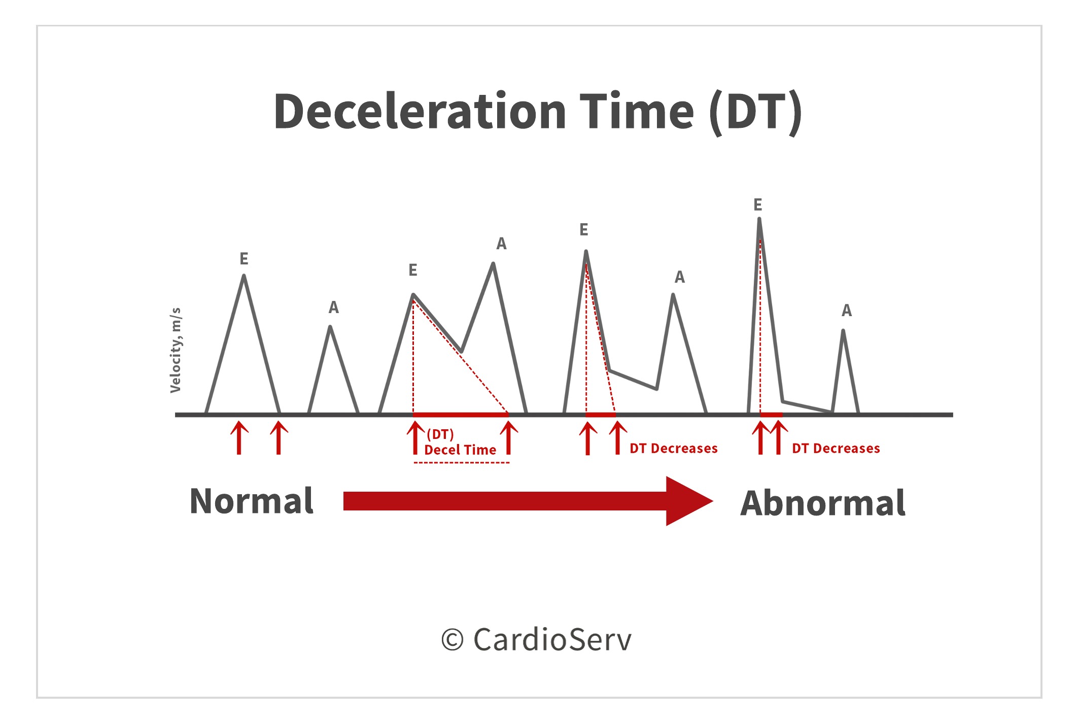 Transmitral inflow velocity patterns, E/A ratio, and mean left