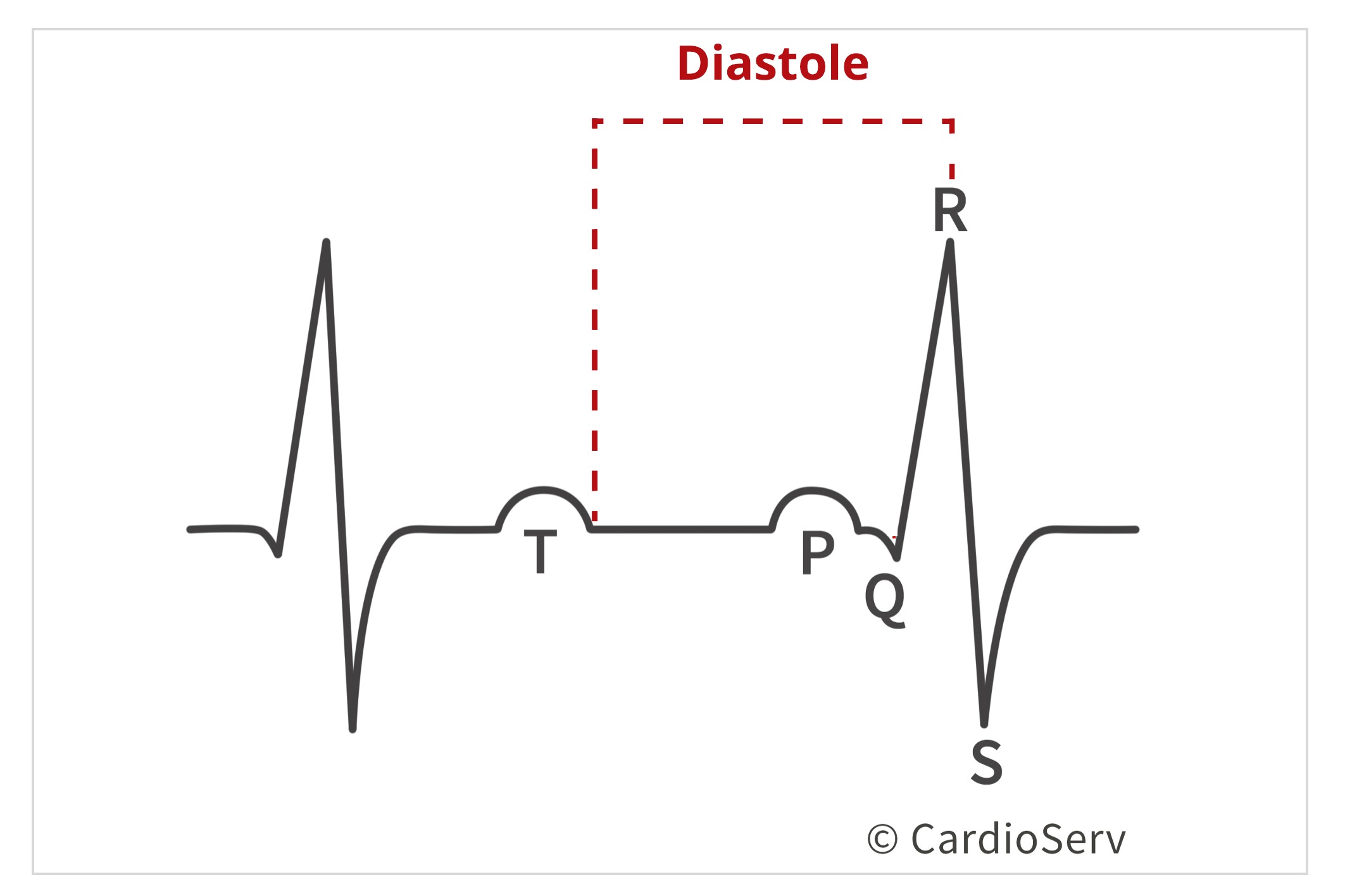 Diastole in Cardiac Cycle 