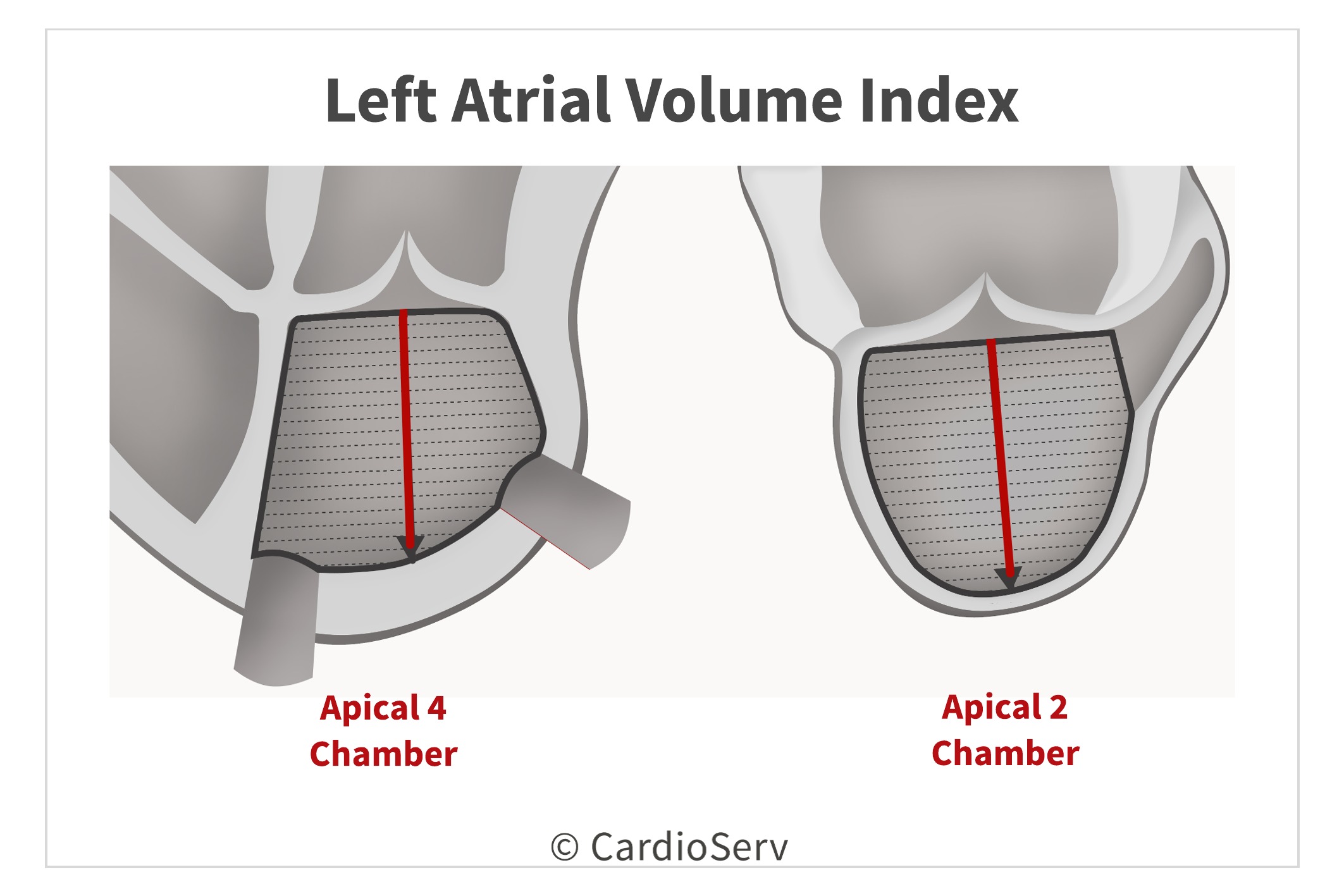 Left Atrial Volume Index