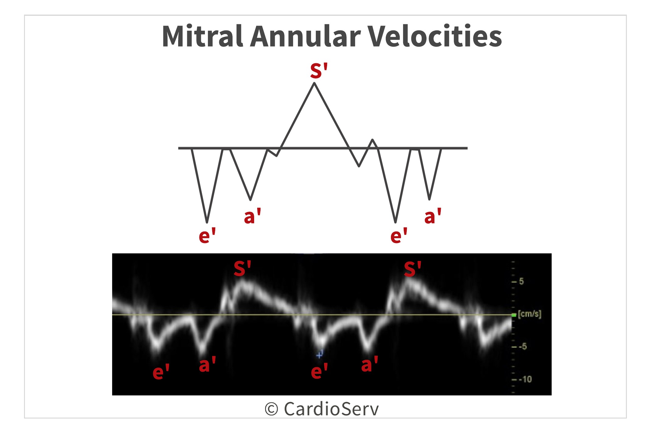 Mitral Annular Velocities Diastolic Function Evaluation Echo
