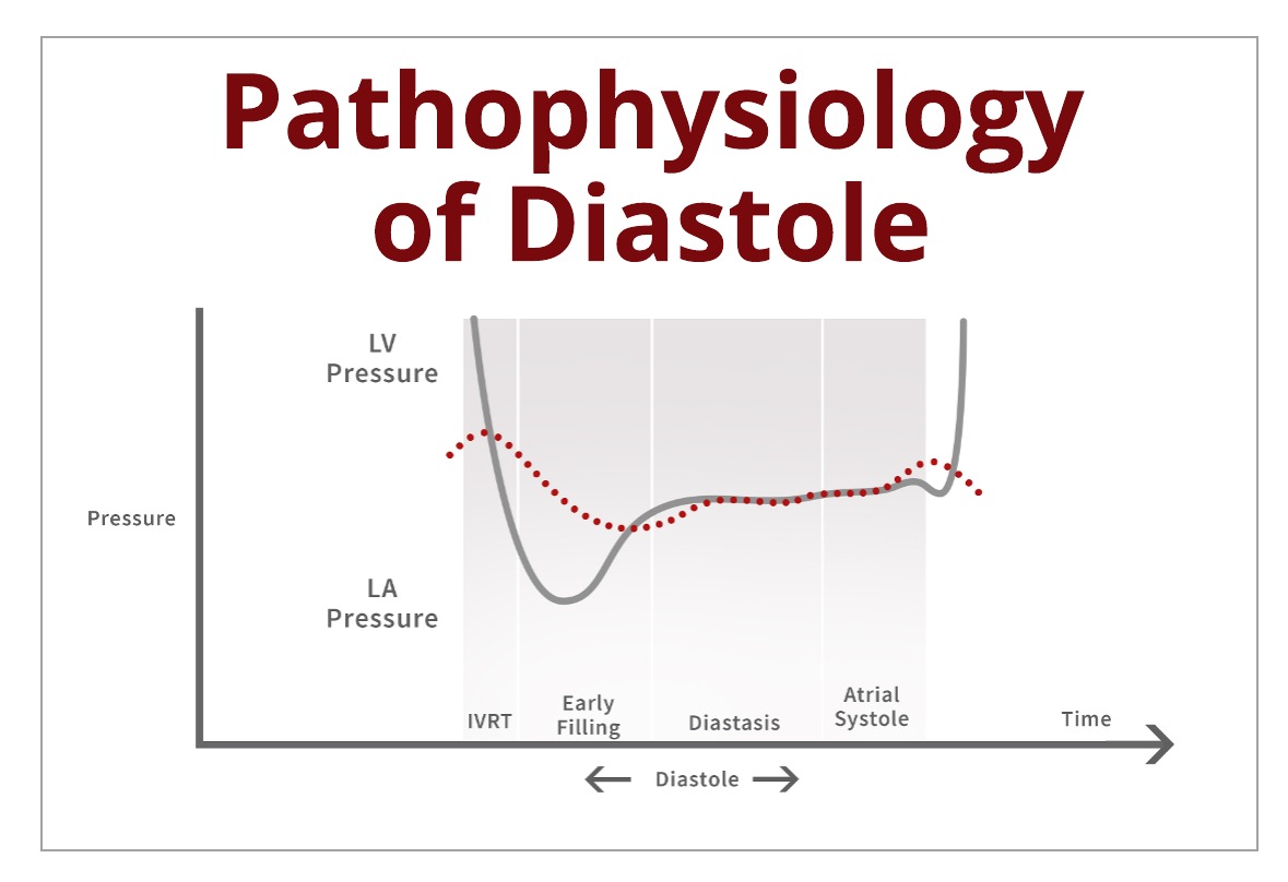 Understanding the Basics: Pathophysiology of Diastole