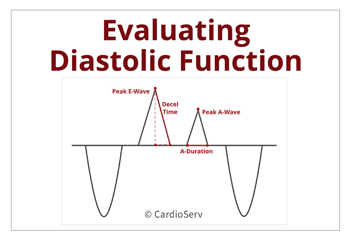 Understanding the Basics: Evaluating Diastolic Function