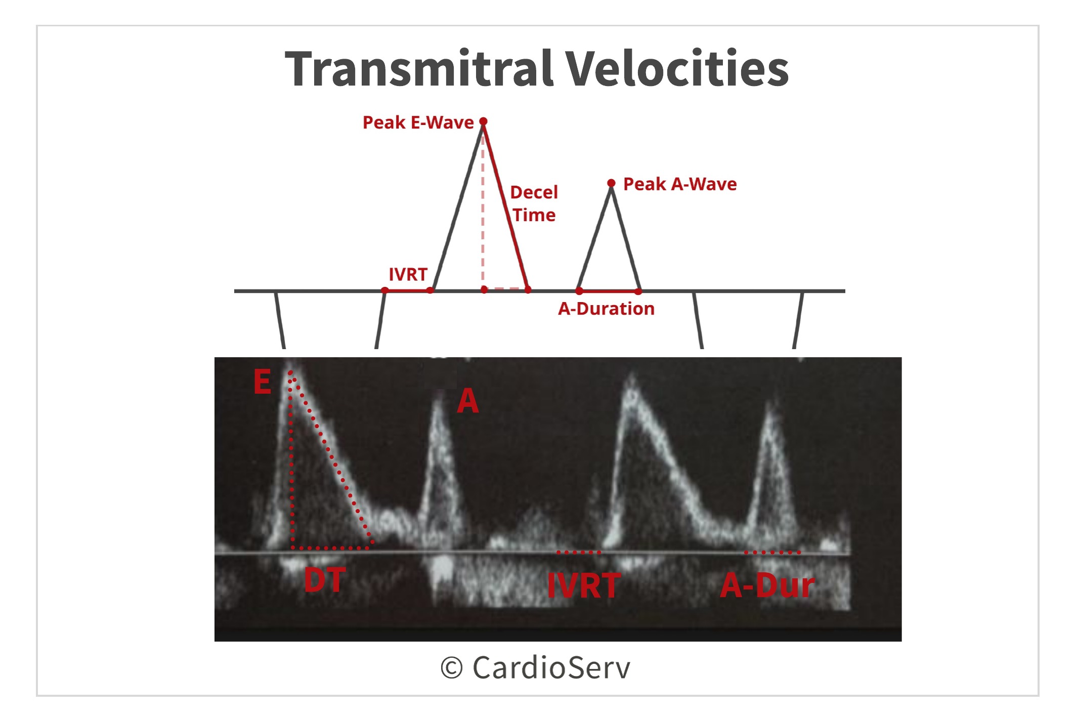 Transmitral Flow Velocities Diastolic Function Mitral Inflow 