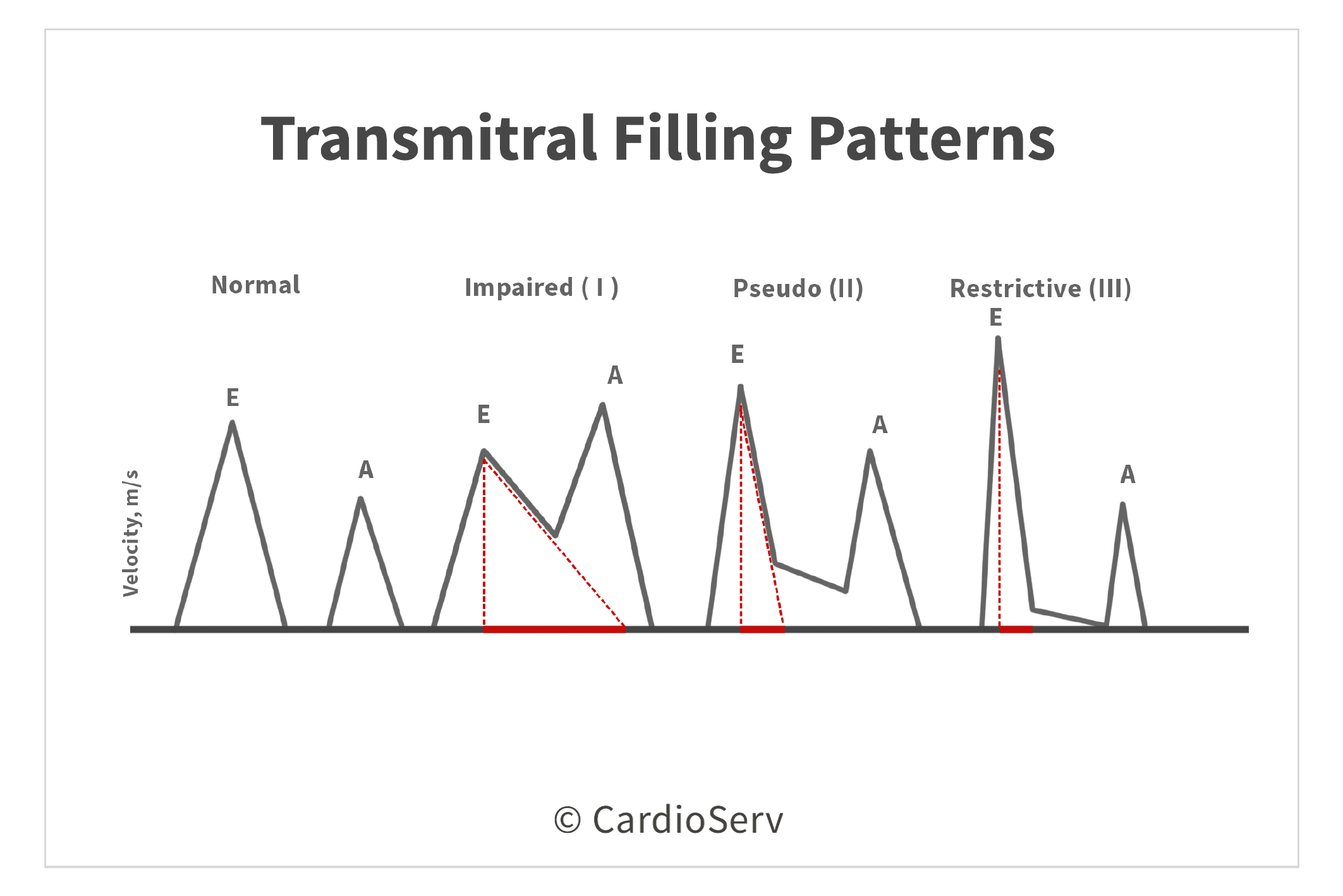 Transmitral Filling Patterns Diastolic Function