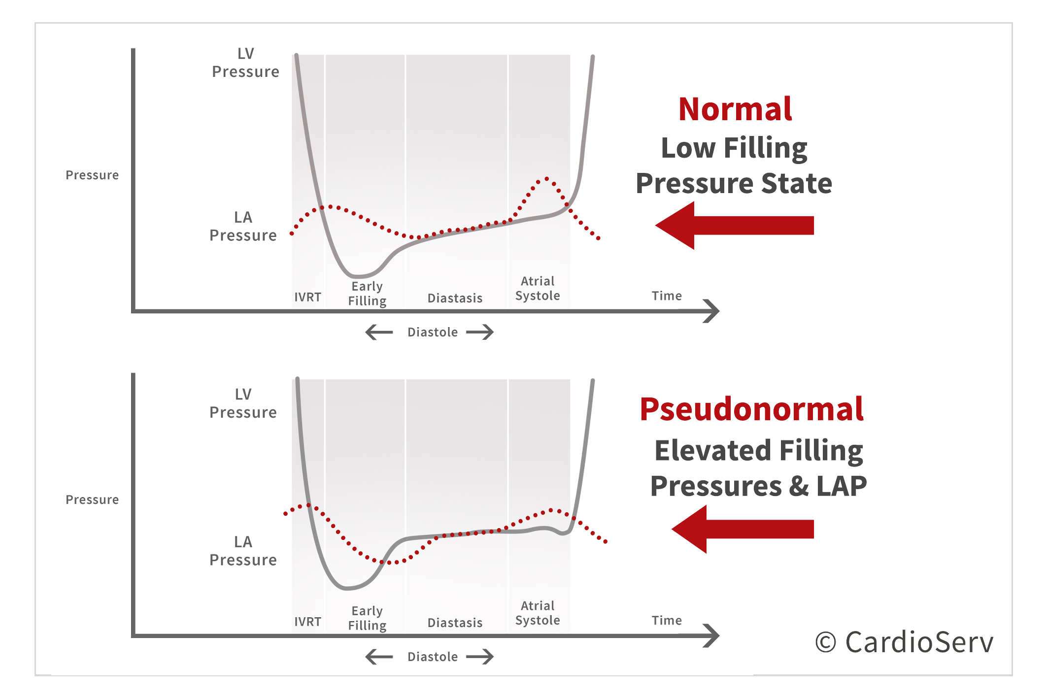 Normal vs Pseudonormal Pressure Change Left Ventricle and Left Atrium Diastolic Dysfunction