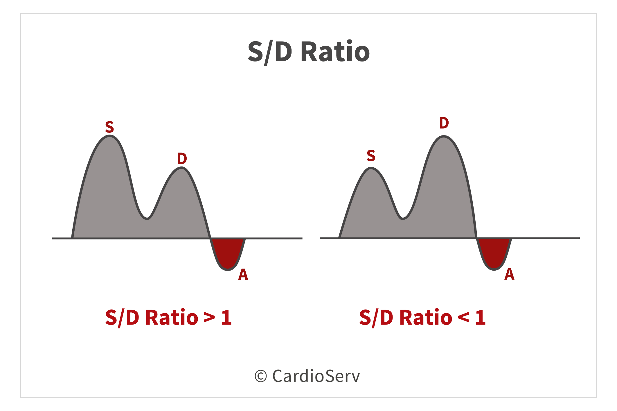 Pulmonary Vein S/D Ratio Diastolic Function