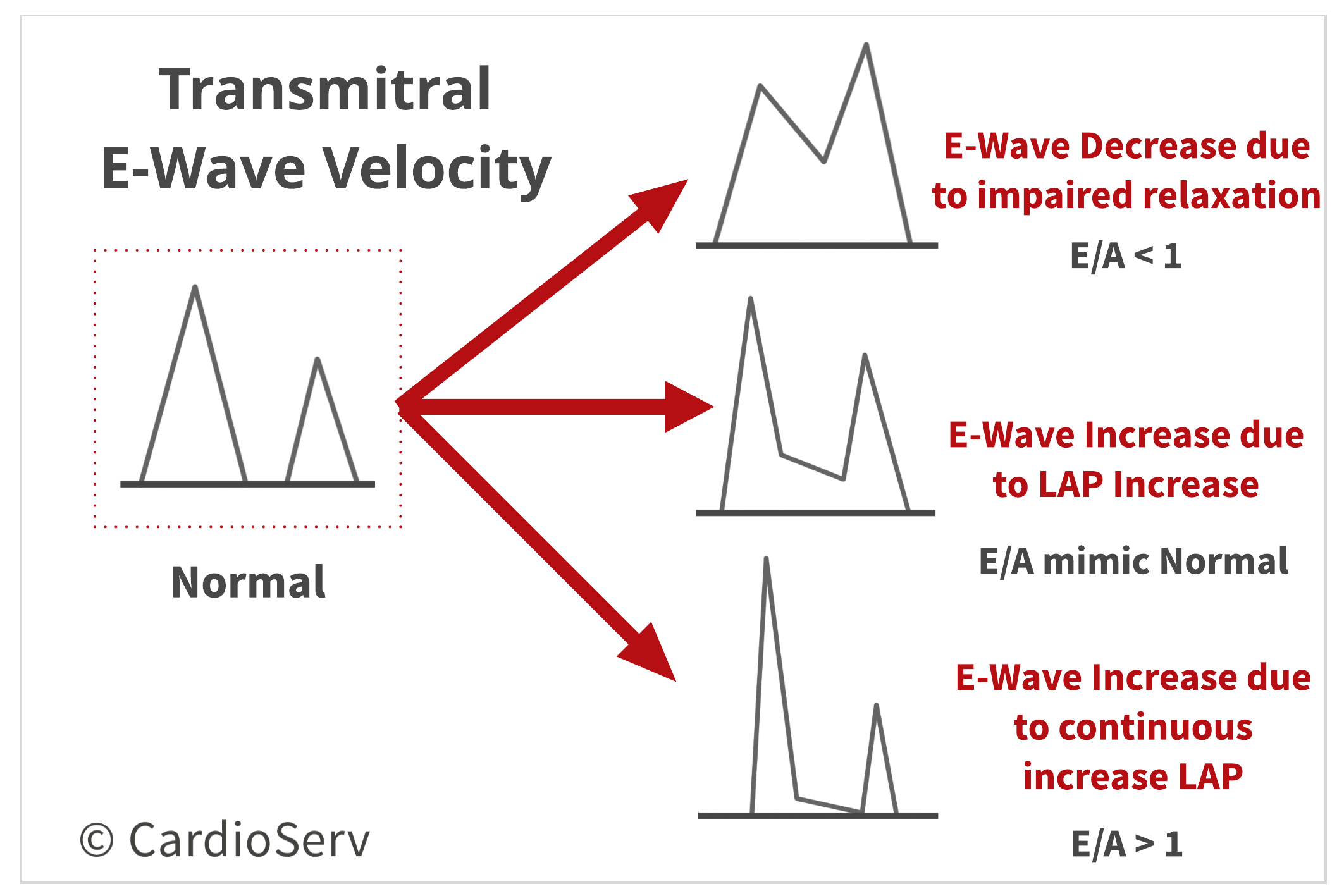 Transmitral E-Wave Velocity