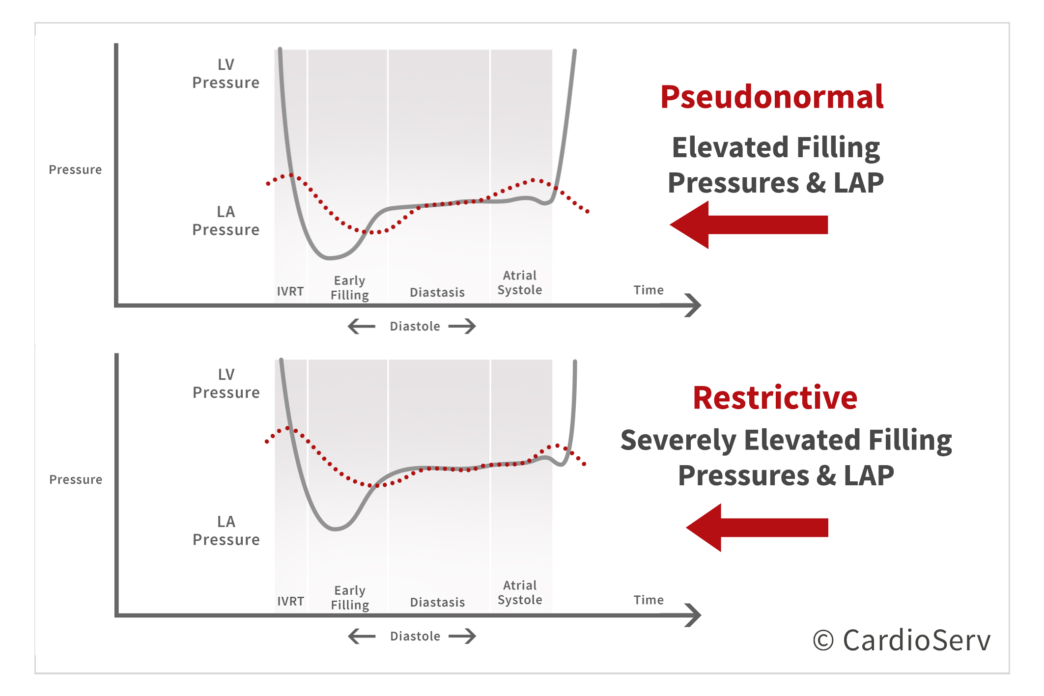 Pseudonormal vs Restrictive Pressure Change Left Ventricle and Left Atrium Diastolic Dysfunction
