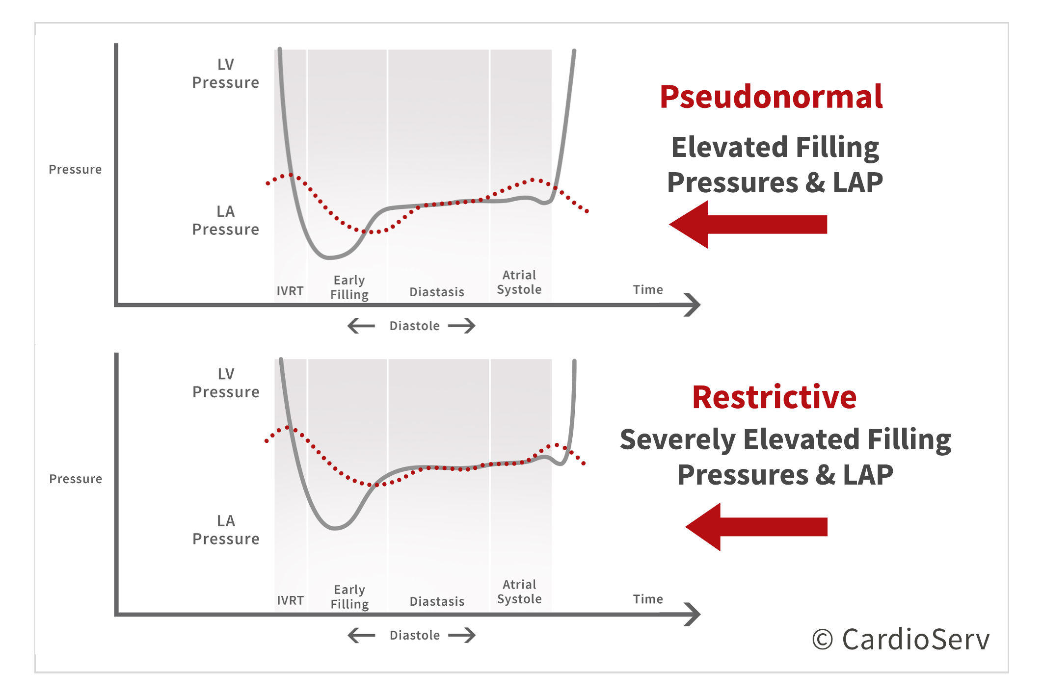 Understanding the Basics: LV Filling Patterns Cardioserv