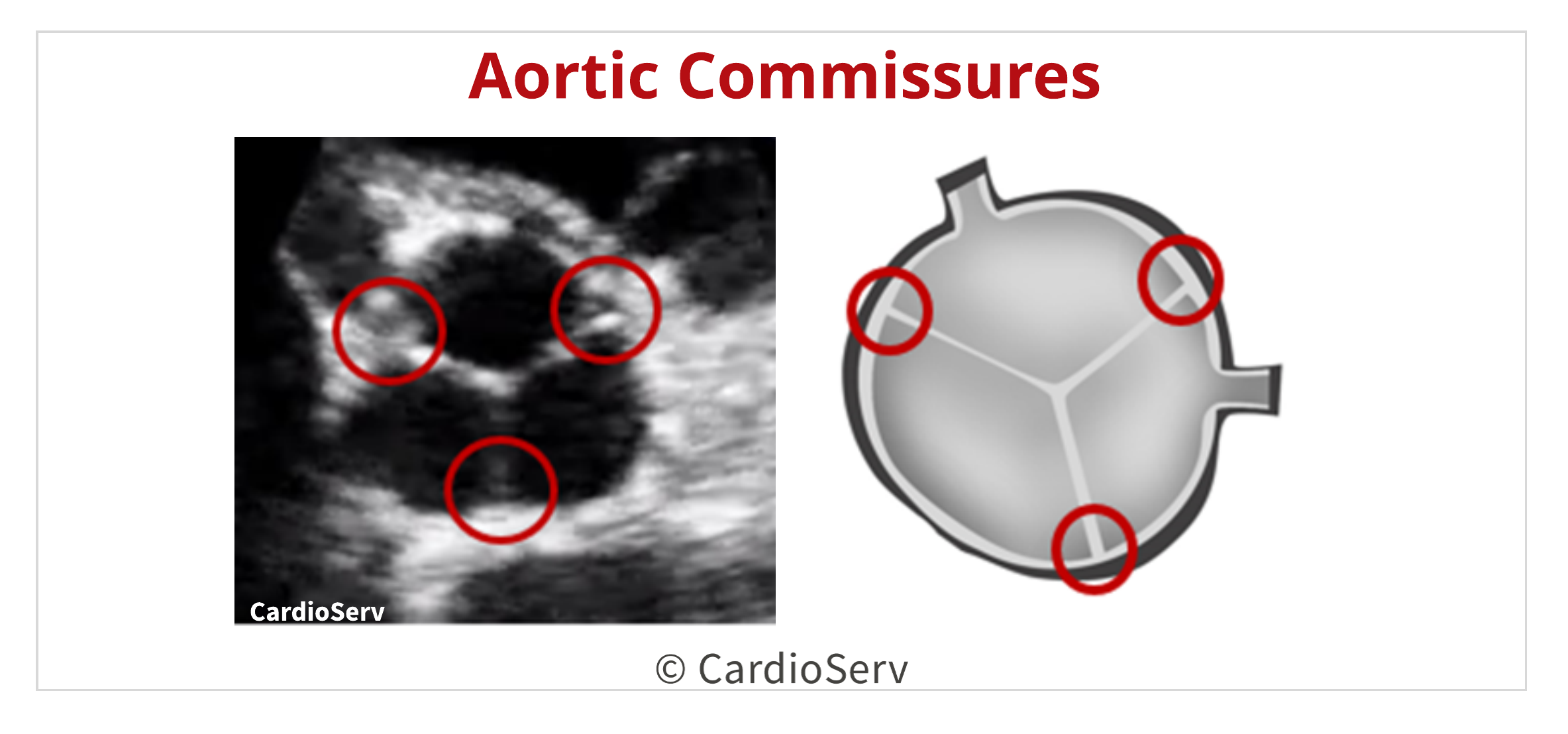 Aorta Valve Anatomy