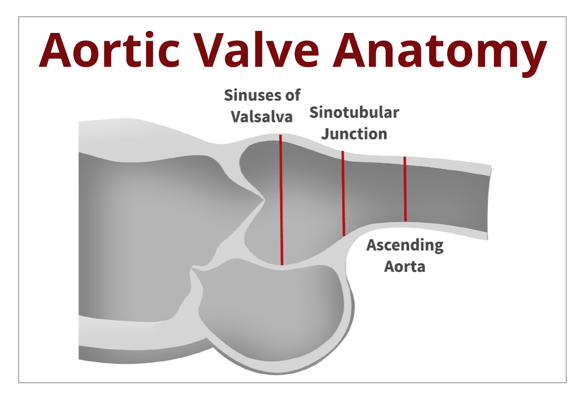 Back to the Basics: Aortic Valve Anatomy