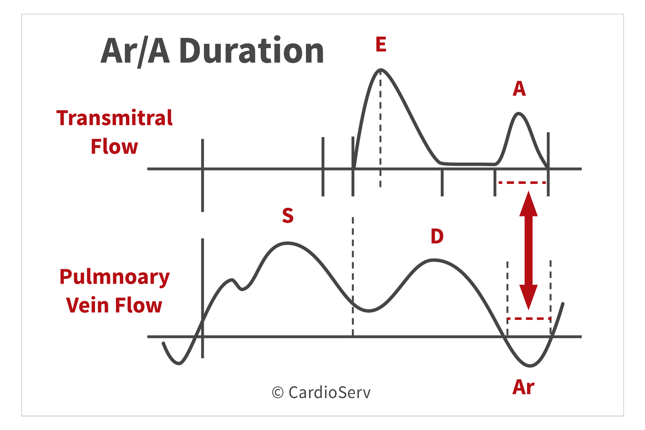 Specific Echo Parameters that Indicate Elevated LAP Cardioserv