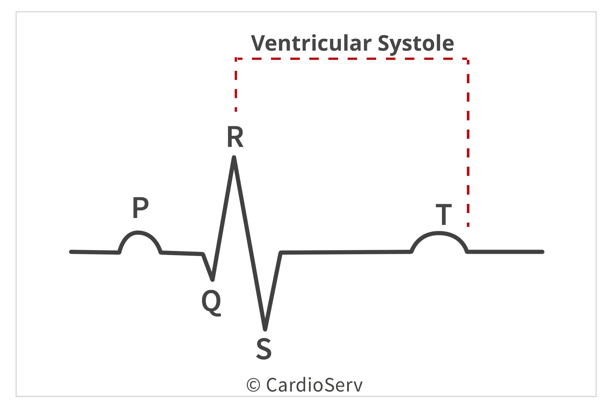 Ventricular Systole