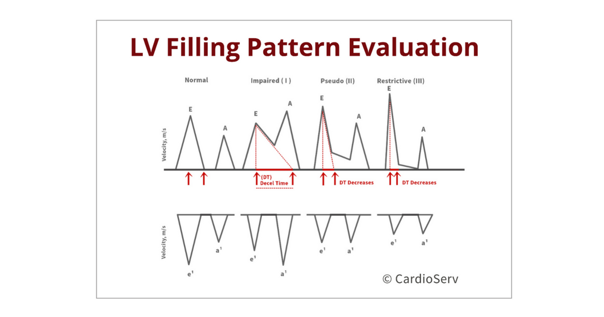 Understanding the Basics: LV Filling Patterns Cardioserv