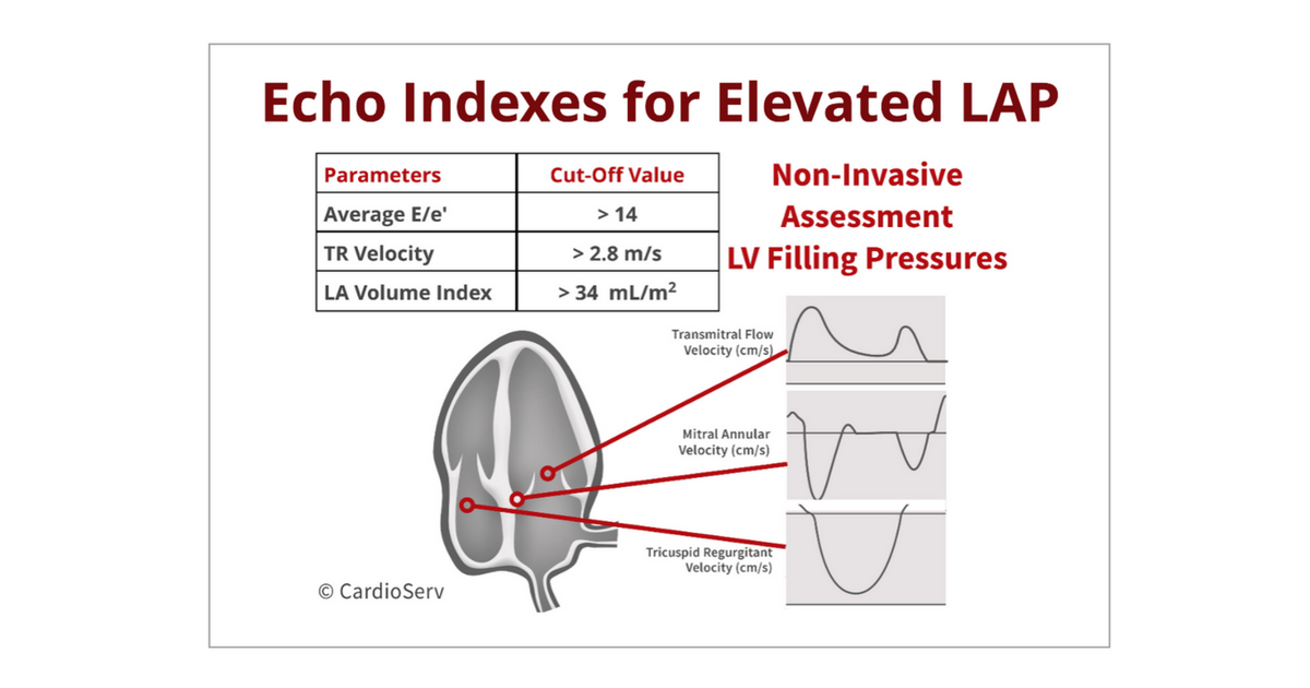 Understanding the Basics: LV Filling Patterns Cardioserv