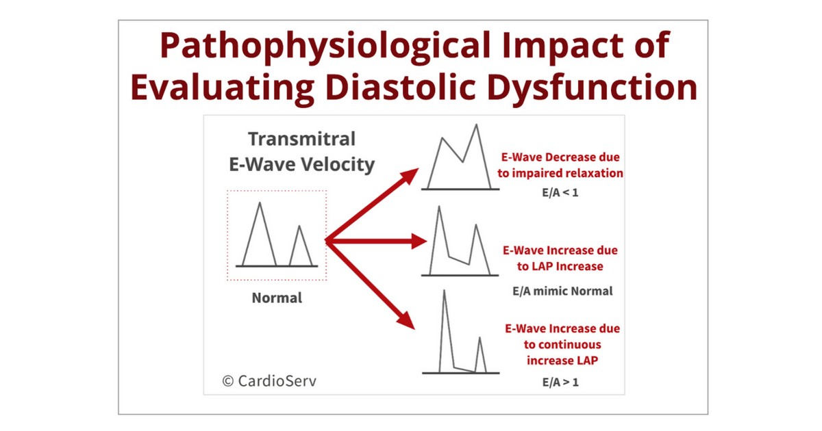 Understanding the Basics: LV Filling Patterns Cardioserv