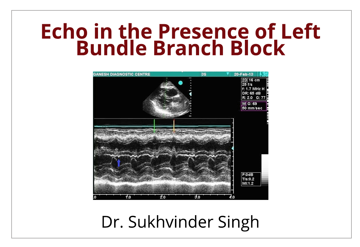 Echocardiography in the Presence of Left Bundle Branch Block