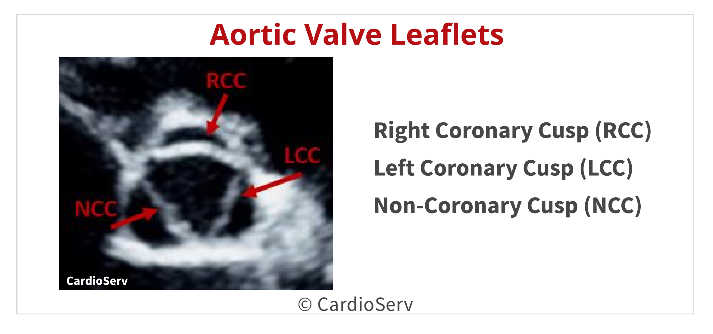 Aortic Valve Leaflet Cusp Echo