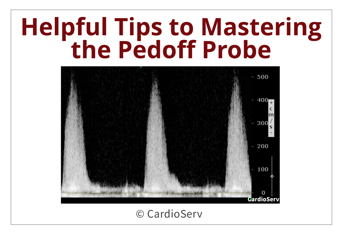 Helpful Tips to Mastering the Pedoff Probe!