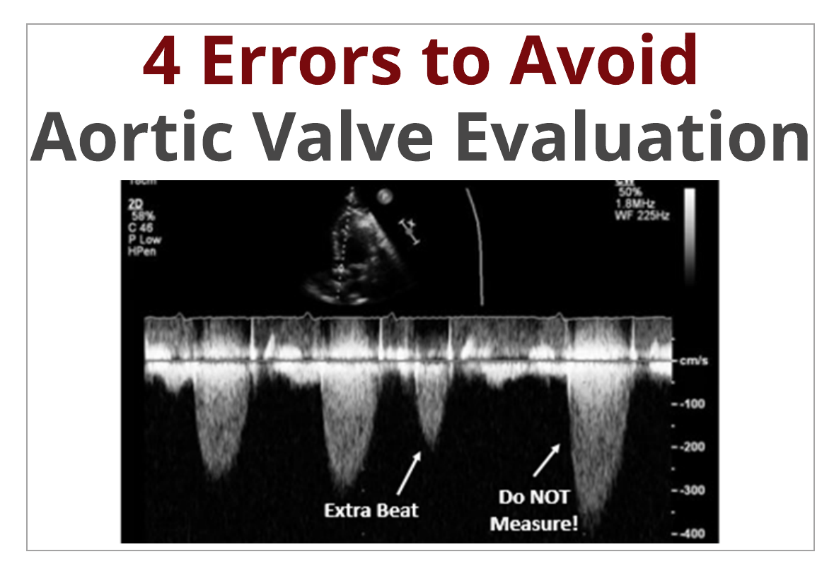 4 Errors to Avoid when Measuring Aortic Valve Velocity