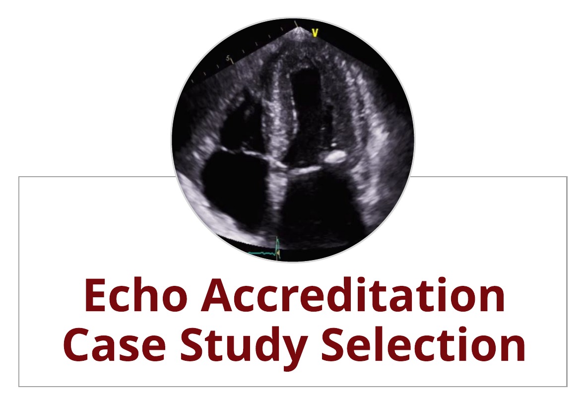 Echo Accreditation:  5 Tips for Easier Case Study Selection