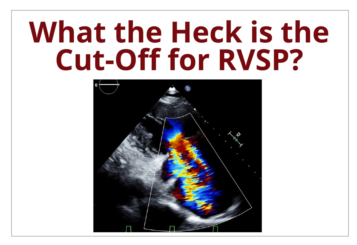 What the Heck is the Cut-Off Value for RVSP?!