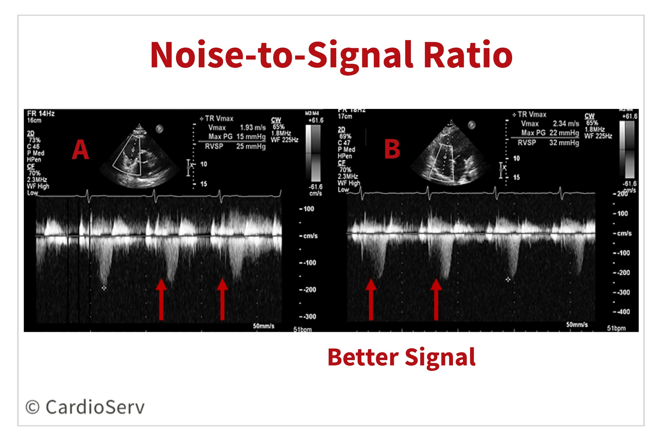 Noise-to-Signal Ratio Echo