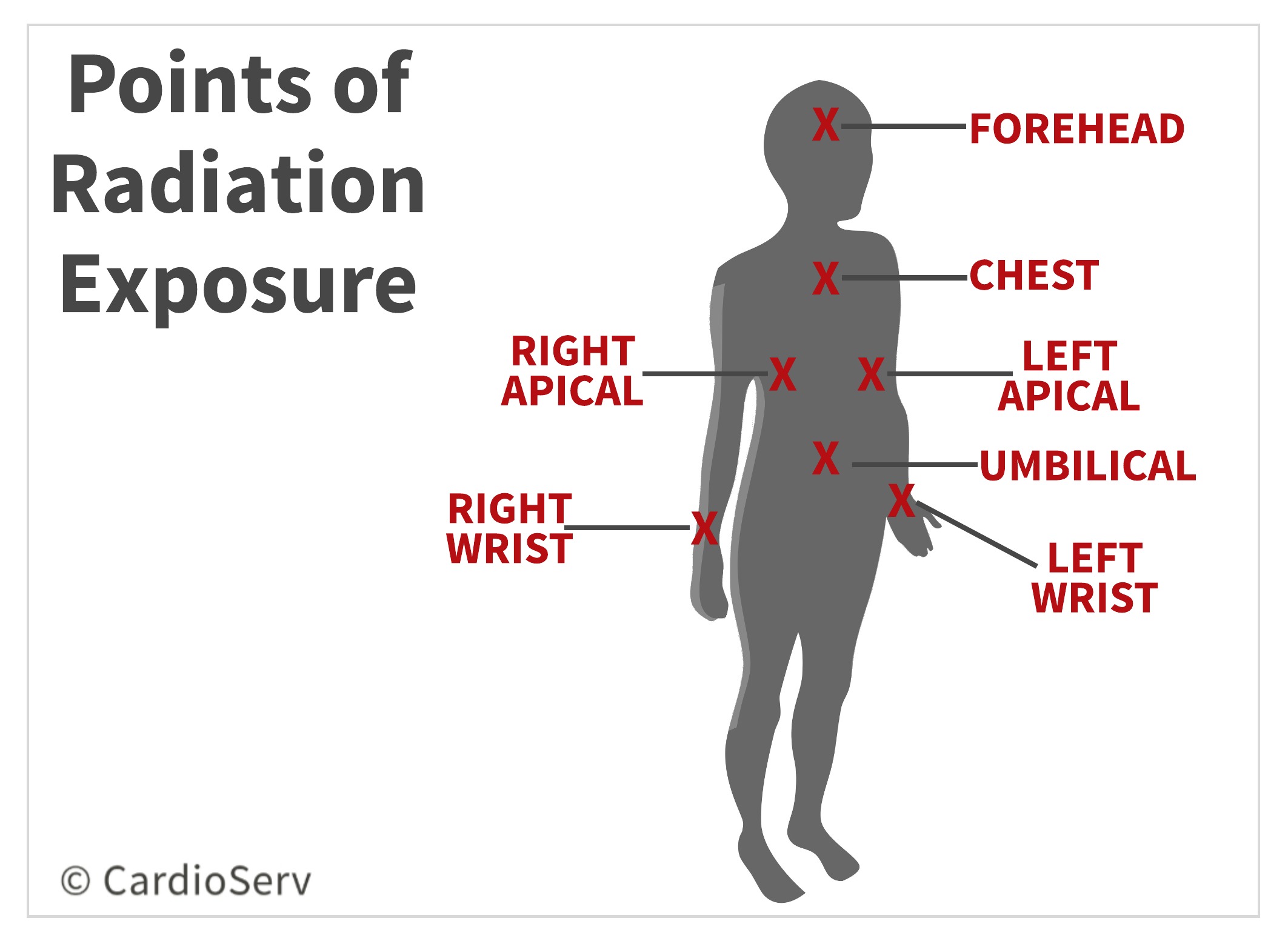 Points of Radiation Exposure to Echocardiographers Echo