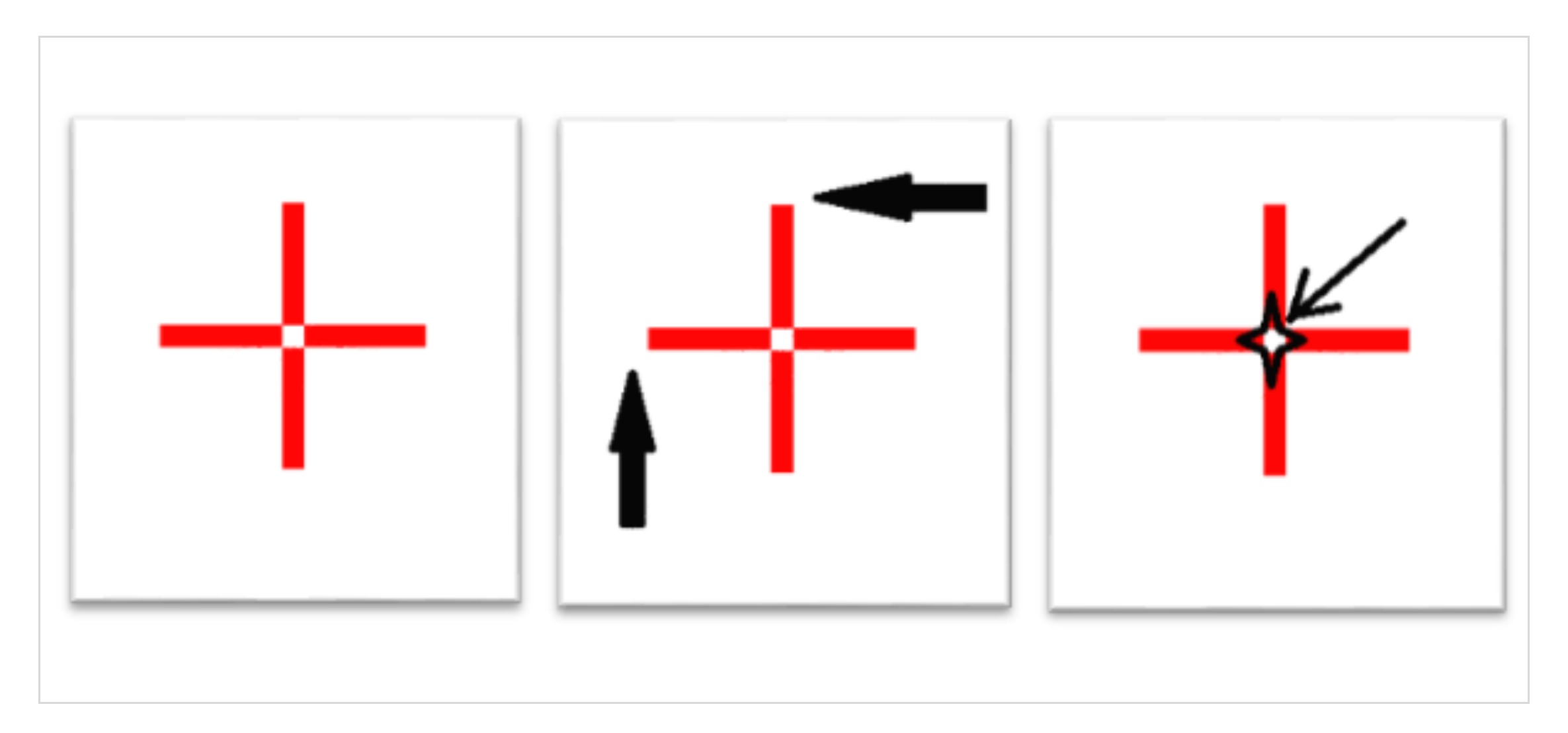 Calipers Ultrasound Measurements