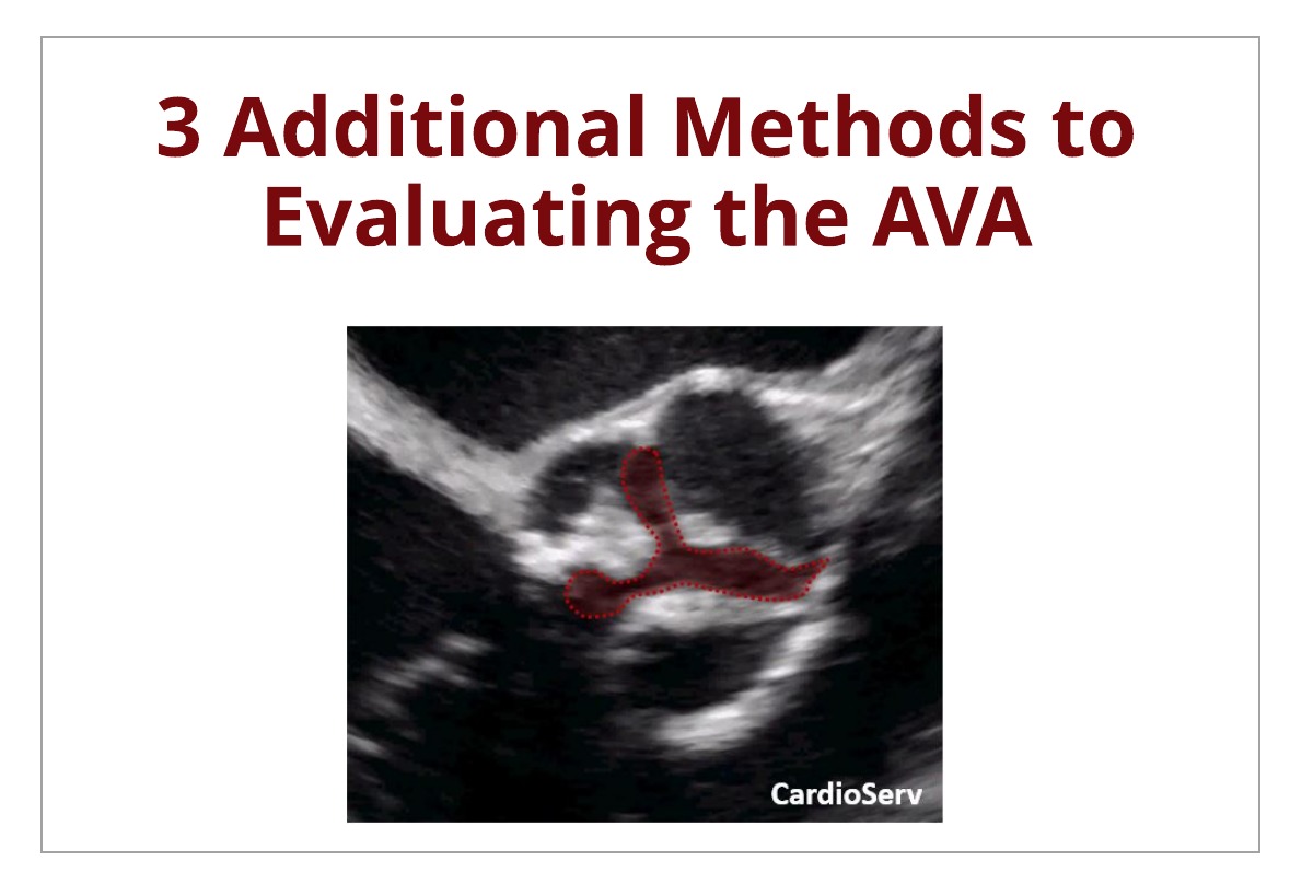 3 Additional Methods to Evaluating the AVA