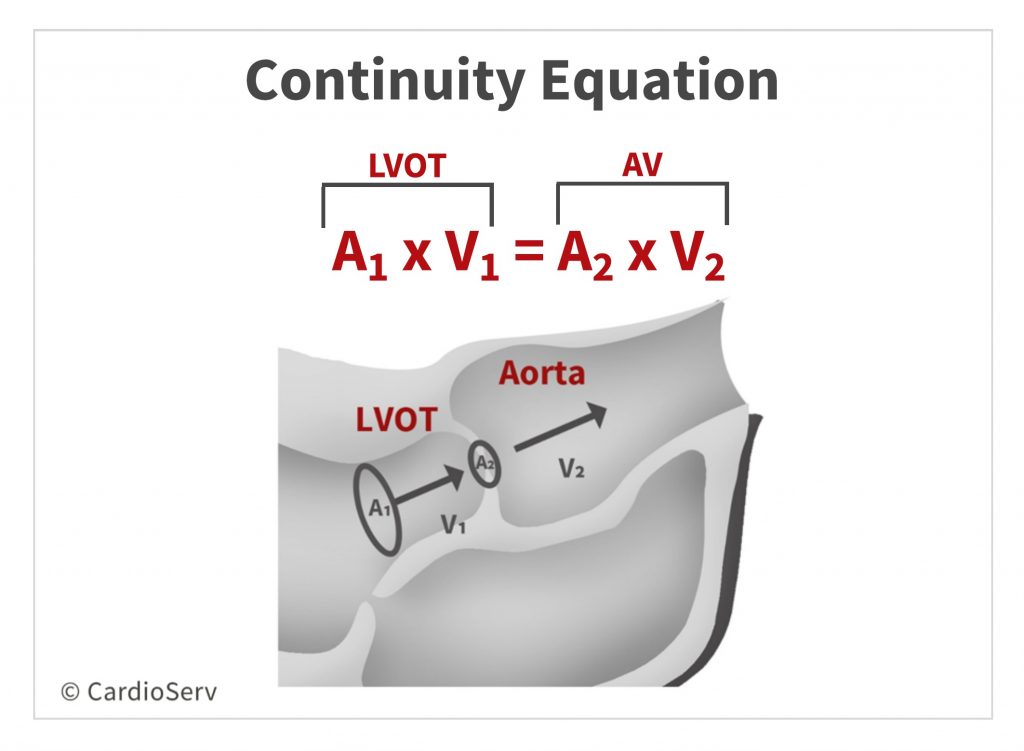Aortic Stenosis Breaking Down The Continuity Equation Cardioserv