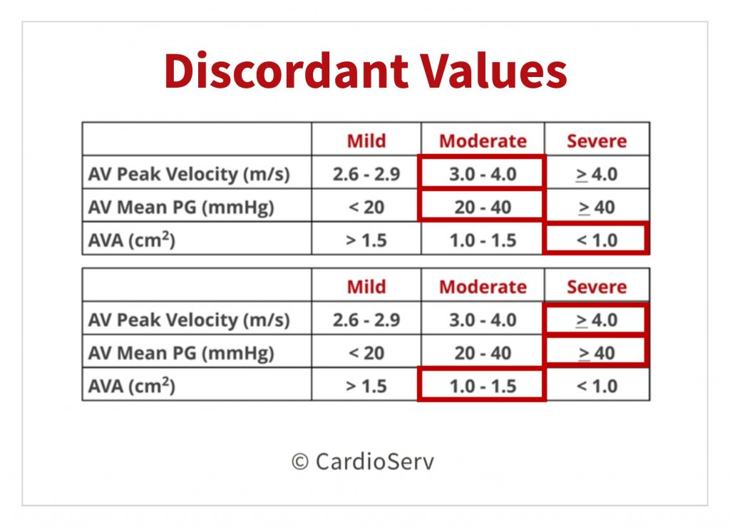 Discordant Values Aortic Stenosis Echo