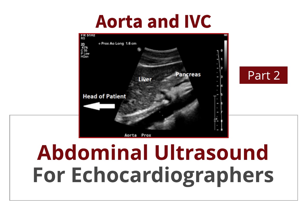 Abdominal Ultrasound for Echocardiographers:  Aorta and IVC