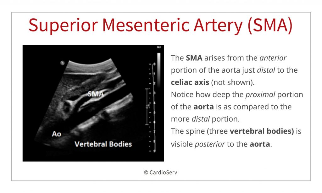 branches of the aorta - visceral ultrasound - SMA