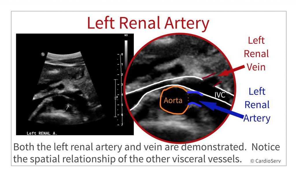 branches of aorta - renal artery