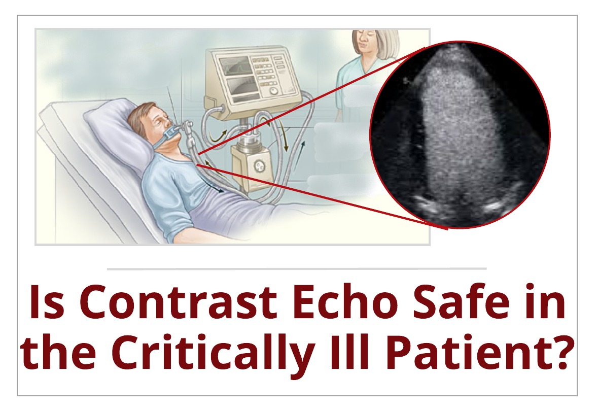 Is Contrast Echo Safe for the Critically Ill Patient?