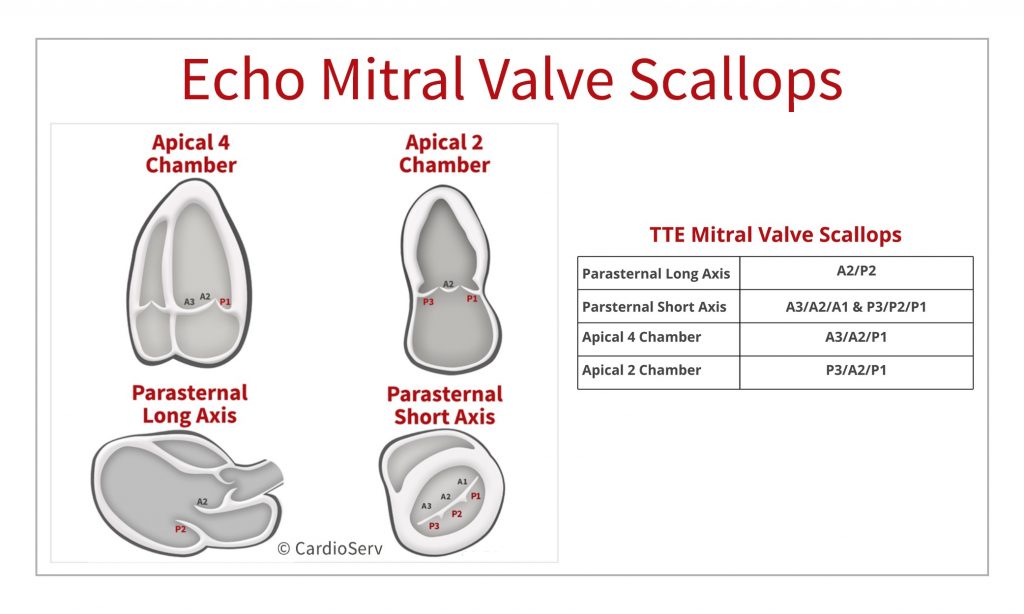 MV Scallops echocardiogram - mitraclip protocol