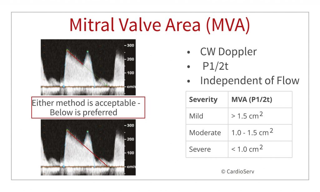 MVA - Pressure Half Time - Mitraclip scanning protocol