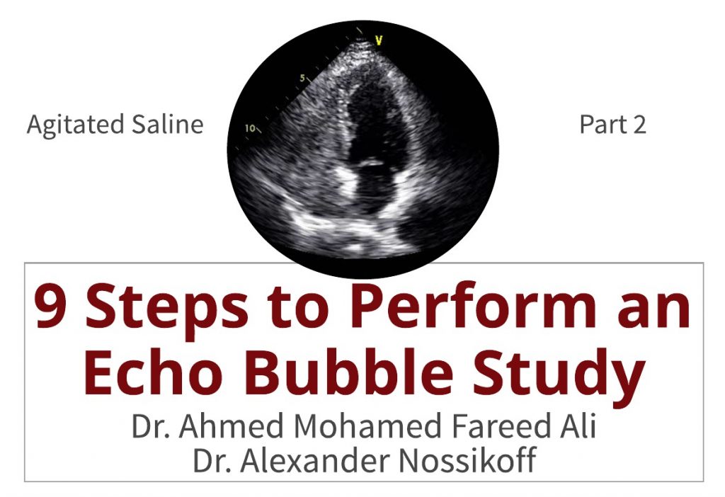 how to perform echo bubble study