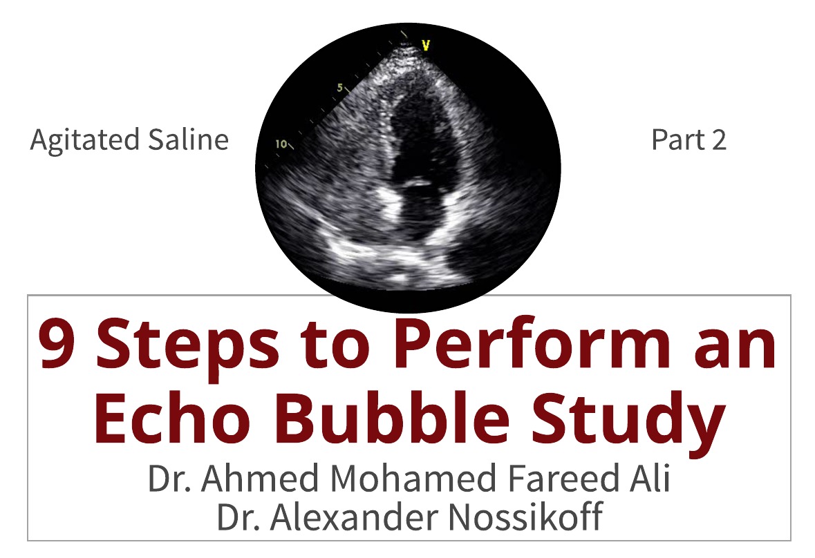 9 Steps to Perform an Echo Bubble Study