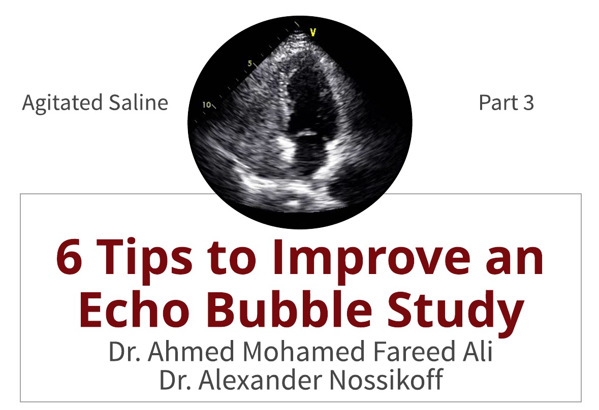 6 Tips to Improve an Echo Bubble Study!