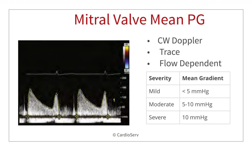 MV mean PG - mitraclip scanning protocol