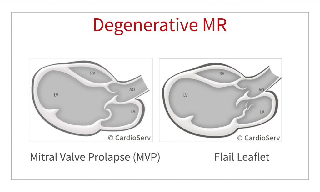 mitraclip echo scanning protocol