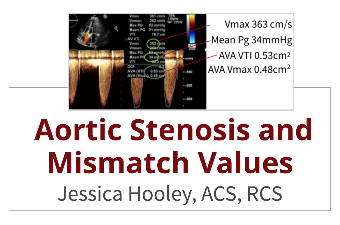 Aortic Stenosis and Mismatch Values