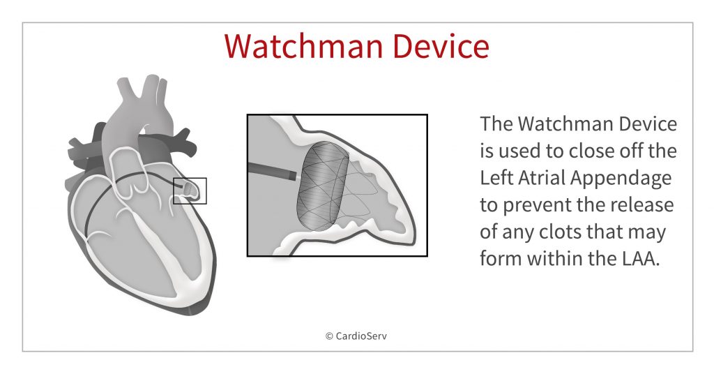 Watchman Device Diagram