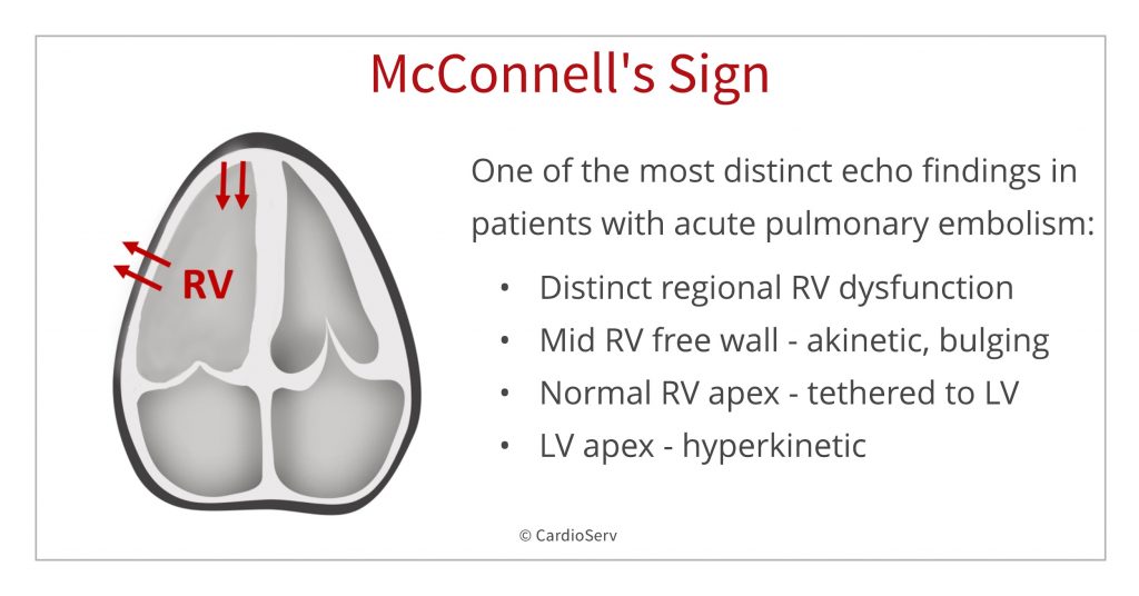 McConnell's Sign Echo