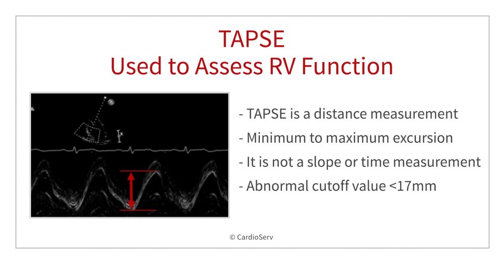 TAPSE Echo measurement used to assess RV function
