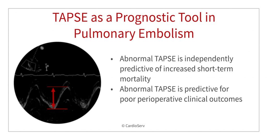 TAPSE is a prognostic tool in pulmonary embolism