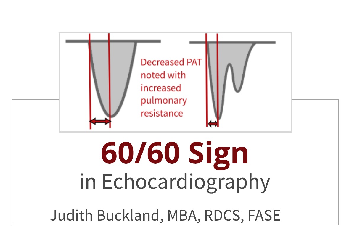 60/60 Sign in Echocardiography