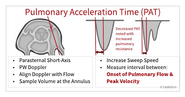 measure pulmonary acceleration time in parasternal short axis flow at the annulus of the PV using PW Doppler